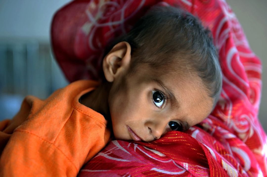 NPR: 2 Hours for Afghanistan—30 Seconds for US Starving Afghans